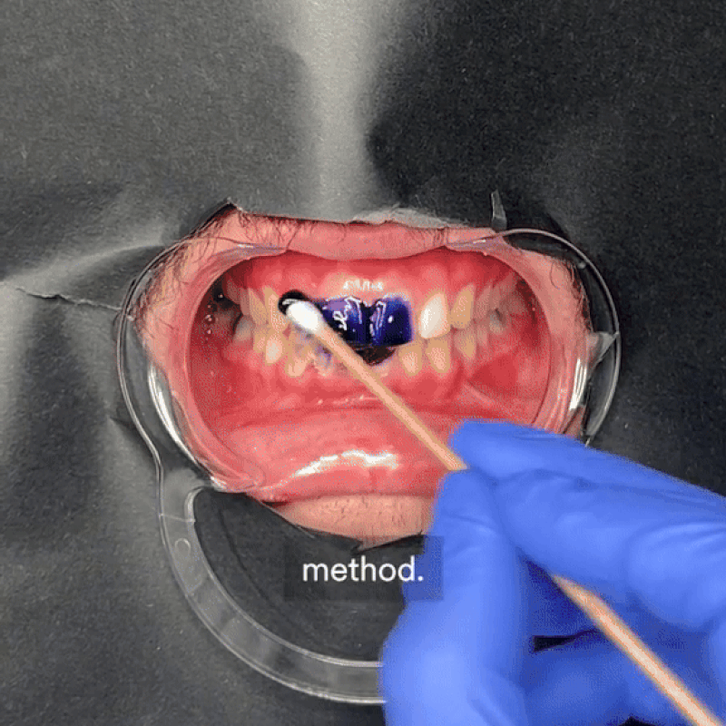 PURPLE POWER SMILE Blanqueador Dental